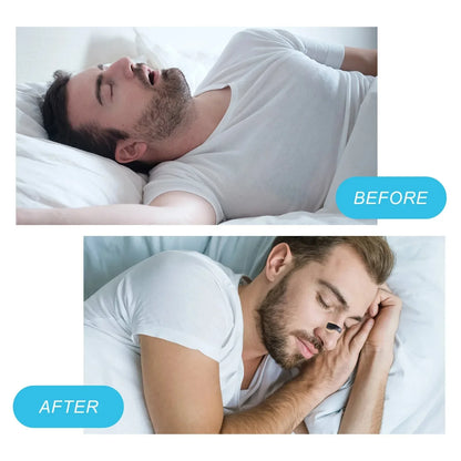 Our 30 day nasal strips